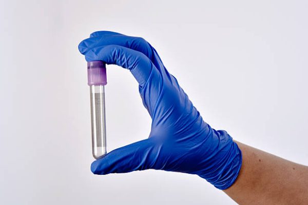 Macarthur Vet Pre-Anaesthetic Blood Testing 1 Macarthur Vet Pre-Anaesthetic Blood Testing 1